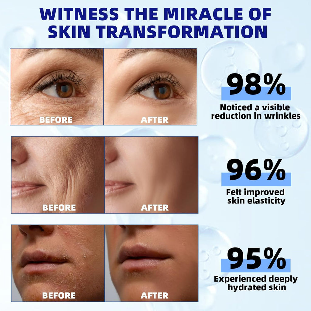 Retinol Serum for Face, 2.5% Retinol Intense Night Serum with Squalane,Vitamin C & E & B3,Hyaluronic Acid for Lines, Wrinkles & Premature Sun Damage to Resurface & Hydrate 30 ml/ 1 Fl oz Clarke's Vibe Store